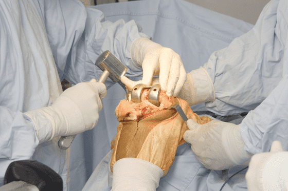 Orthopedic